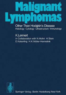 Malignant Lymphomas Other than Hodgkins Disease 1