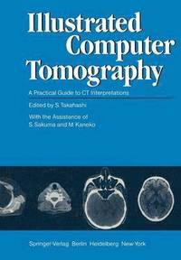 bokomslag Illustrated Computer Tomography