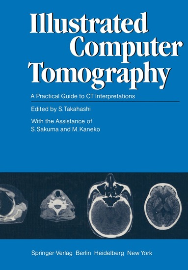 S. Takahashi, S. Sakuma, M. Kaneko - Illustrated Computer Tomography, Häftad