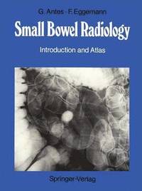 bokomslag Small Bowel Radiology