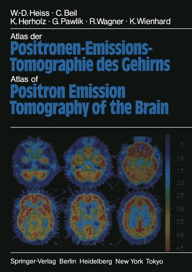 W.-D. Heiss, C. Beil, K. Herholz, R. Wagner, G. Pawlik, K. Wienhard - Atlas der Positronen-Emissions-Tomographie des Gehirns / Atlas of Positron Emission Tomography of the Brain, Häftad