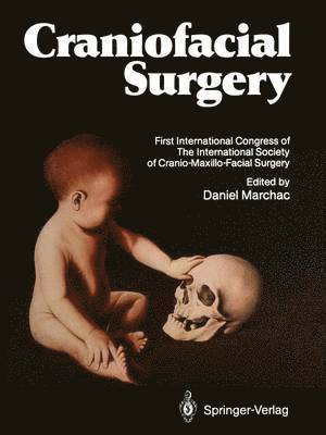 Daniel Marchac - Craniofacial Surgery, Häftad