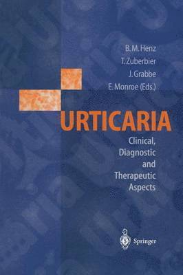 Urticaria 1