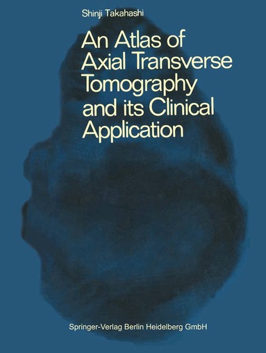 A.S. Takahashi - Atlas of Axial Transverse Tomography and its Clinical Application, Häftad