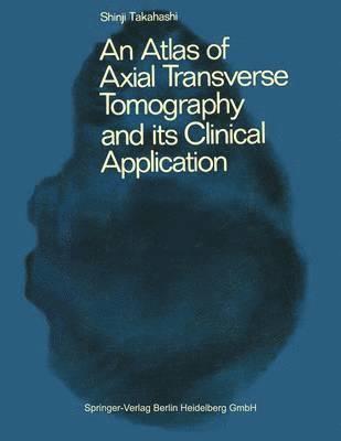 An Atlas of Axial Transverse Tomography and its Clinical Application 1