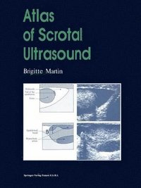 bokomslag Atlas of Scrotal Ultrasound