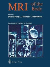 bokomslag MRI of the Body