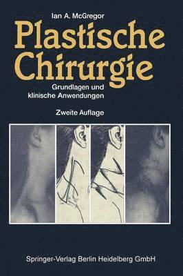 bokomslag Plastische Chirurgie