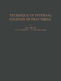 bokomslag Technique of Internal Fixation of Fractures