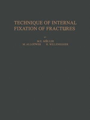 bokomslag Technique of Internal Fixation of Fractures