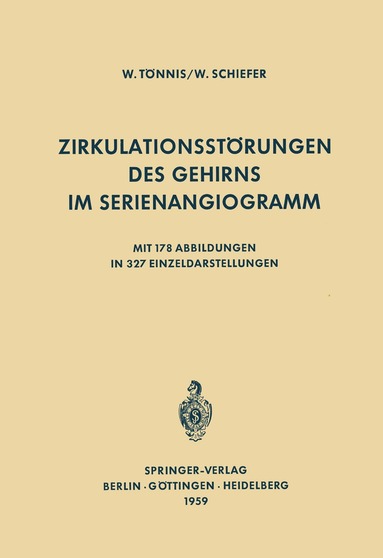 W. Tönnis, W. Schiefer - Zirkulationsstörungen des Gehirns im Serienangiogramm, Häftad