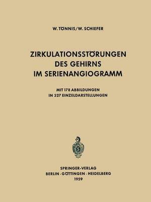 bokomslag Zirkulationsstrungen des Gehirns im Serienangiogramm