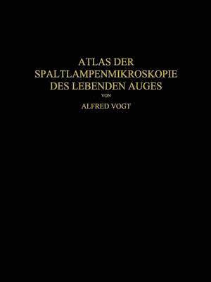 Atlas der Spaltlampenmikroskopie des Lebenden Auges 1