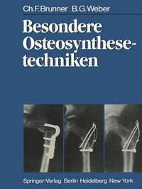 bokomslag Besondere Osteosynthesetechniken