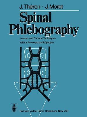 Spinal Phlebography 1