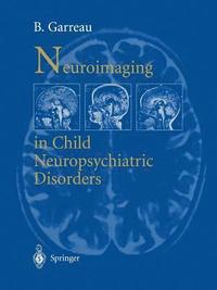 bokomslag Neuroimaging in child neuropsychiatric disorders