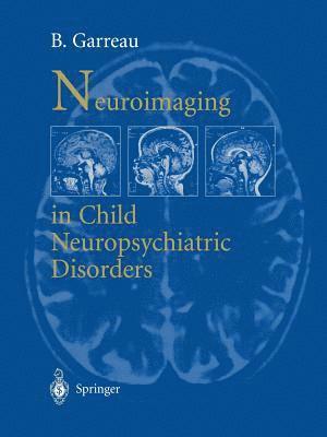 bokomslag Neuroimaging in child neuropsychiatric disorders