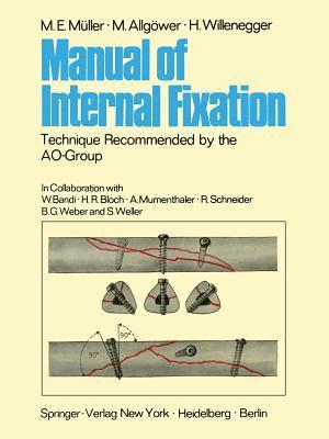 bokomslag Manual of Internal Fixation