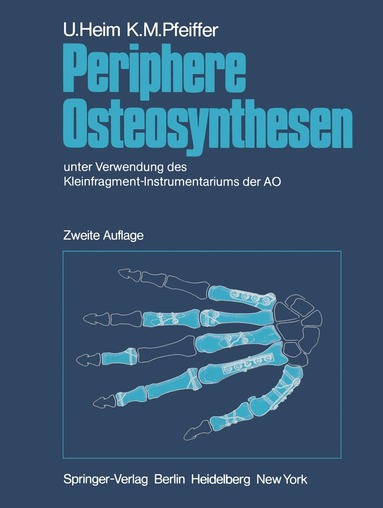 U. Heim, K. M. Pfeiffer - Periphere Osteosynthesen, Häftad