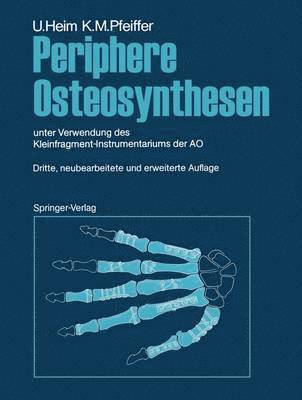 Periphere Osteosynthesen 1