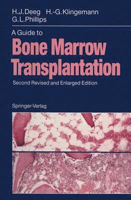 A Guide to Bone Marrow Transplantation 1