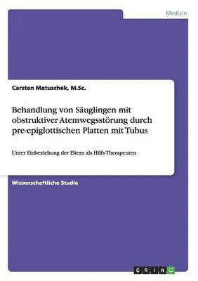 Behandlung von Säuglingen mit obstruktiver Atemwegsstörung durch pre-epiglottischen Platten mit Tubus