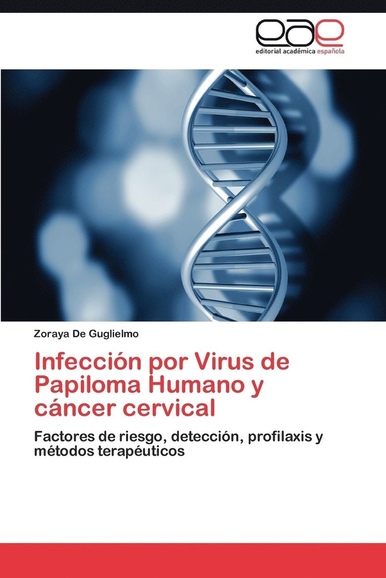 Zoraya De Guglielmo - Infeccion Por Virus de Papiloma Humano y Cancer Cervical, Häftad