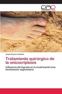 bokomslag Tratamiento quirrgico de la onicocriptosis