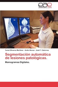 bokomslag Segmentacion Automatica de Lesiones Patologicas.