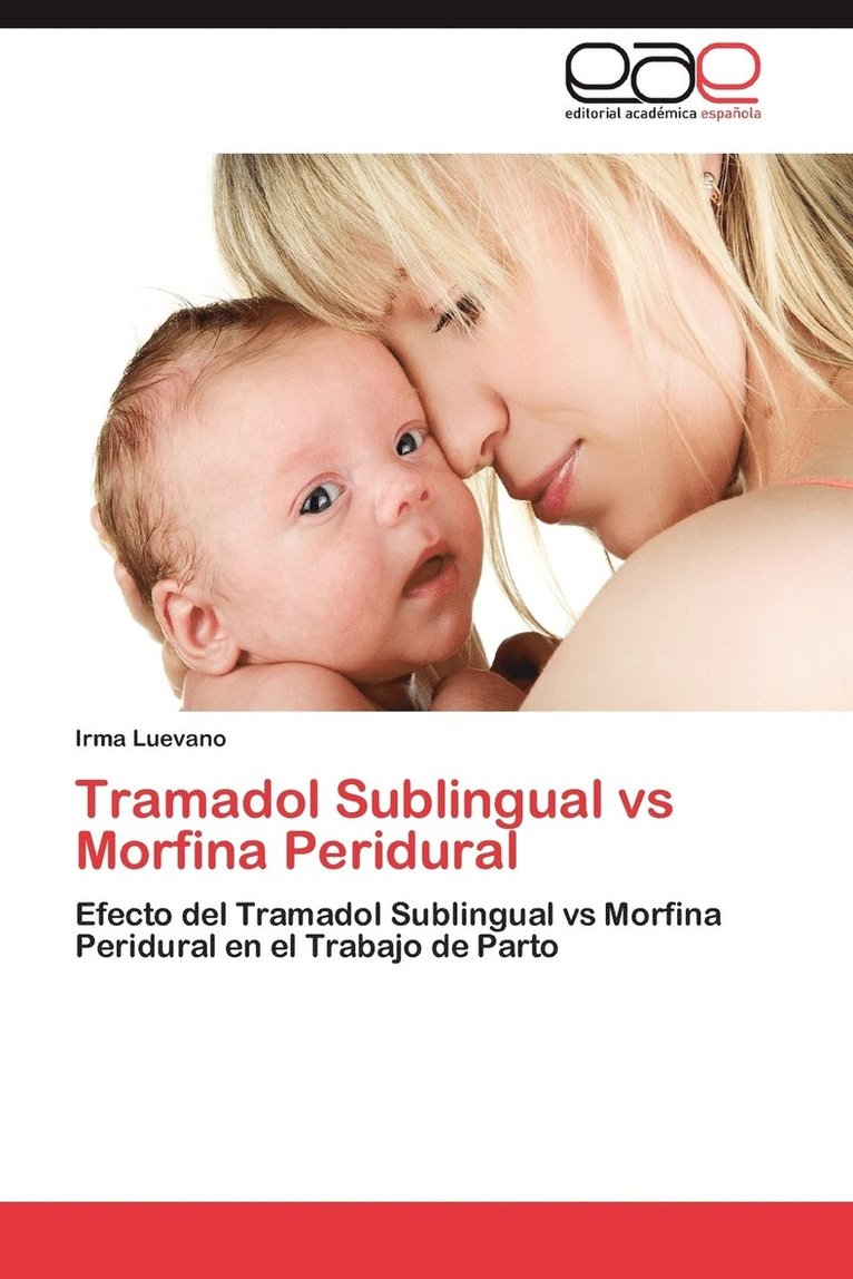 Irma Luevano - Tramadol Sublingual Vs Morfina Peridural, Häftad. Tillgänglighet: Lägg i varukorg