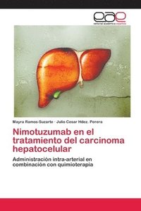 bokomslag Nimotuzumab en el tratamiento del carcinoma hepatocelular