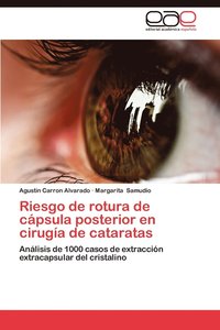 bokomslag Riesgo de Rotura de Capsula Posterior En Cirugia de Cataratas