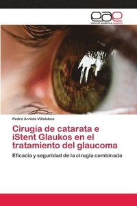 bokomslag Ciruga de catarata e iStent Glaukos en el tratamiento del glaucoma
