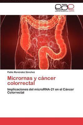 bokomslag Micrornas y Cancer Colorrectal