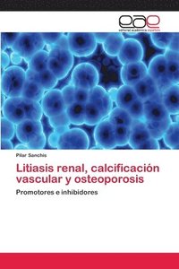 bokomslag Litiasis renal, calcificacin vascular y osteoporosis
