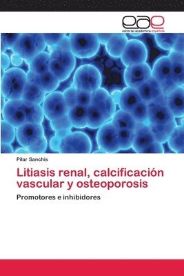 Litiasis renal, calcificacin vascular y osteoporosis 1