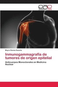 bokomslag Inmunogammagrafa de tumores de origen epitelial