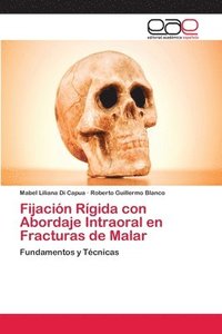 bokomslag Fijacin Rgida con Abordaje Intraoral en Fracturas de Malar
