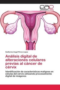bokomslag Anlisis digital de alteraciones celulares previas al cncer de crvix