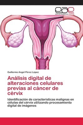 Anlisis digital de alteraciones celulares previas al cncer de crvix 1