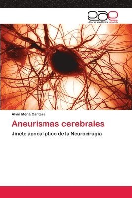 Aneurismas cerebrales 1