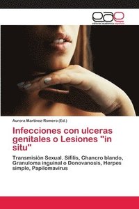 bokomslag Infecciones con ulceras genitales o Lesiones &quot;in situ&quot;