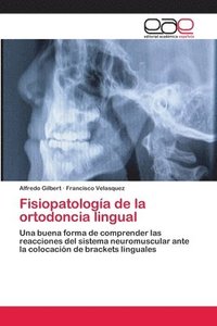 bokomslag Fisiopatologa de la ortodoncia lingual