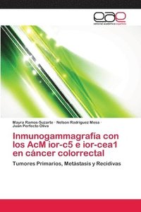 bokomslag Inmunogammagrafa con los AcM ior-c5 e ior-cea1 en cncer colorrectal