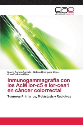 Inmunogammagrafa con los AcM ior-c5 e ior-cea1 en cncer colorrectal 1