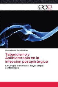bokomslag Tabaquismo y Antibioterapia en la infeccin postquirrgica