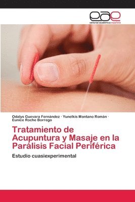 bokomslag Tratamiento de Acupuntura y Masaje en la Parlisis Facial Perifrica