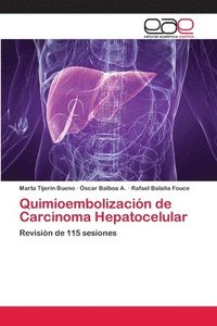 bokomslag Quimioembolizacin de Carcinoma Hepatocelular