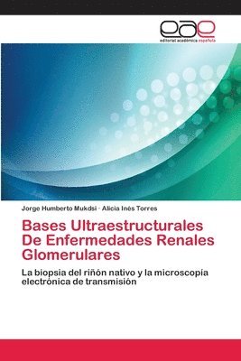 Bases Ultraestructurales De Enfermedades Renales Glomerulares 1