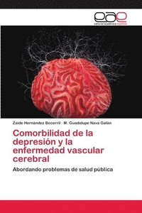 bokomslag Comorbilidad de la depresin y la enfermedad vascular cerebral